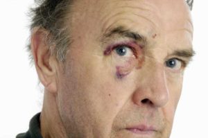 Elder Abuse and Exploitation